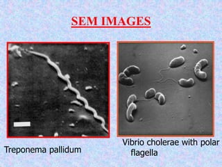 SEM IMAGES
Vibrio cholerae with polar
flagella
Treponema pallidum
 