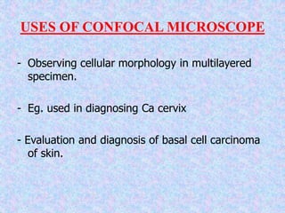 USES OF CONFOCAL MICROSCOPE
- Observing cellular morphology in multilayered
specimen.
- Eg. used in diagnosing Ca cervix
- Evaluation and diagnosis of basal cell carcinoma
of skin.
 