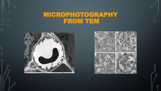 MICROPHOTOGRAPHY
FROM TEM
 