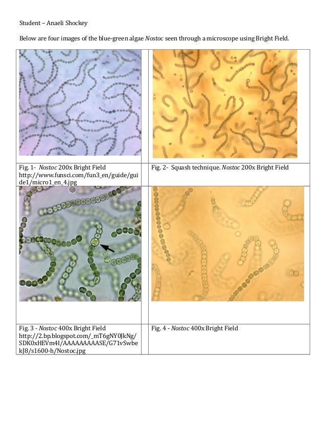 Microscopy. nostoc. brightfield.