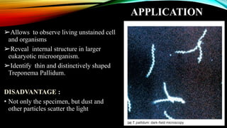 APPLICATION
➢Allows to observe living unstained cell
and organisms
➢Reveal internal structure in larger
eukaryotic microorganism.
➢Identify thin and distinctively shaped
Treponema Pallidum.
DISADVANTAGE :
• Not only the specimen, but dust and
other particles scatter the light
 