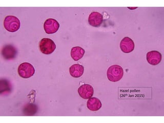 Hazel pollen
(26th Jan 2015)
 