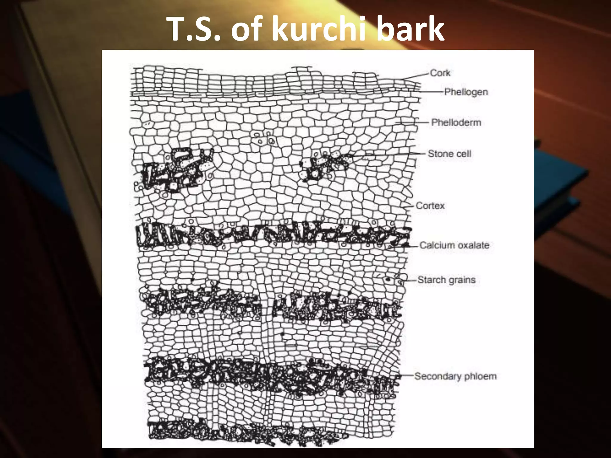 Microscopy of kurchi | PPTX