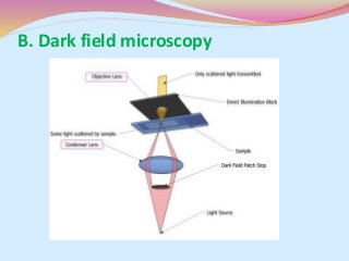 B. Dark field microscopy
 