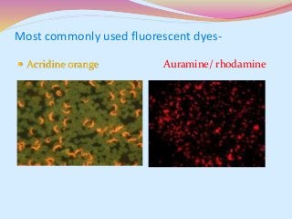 Most commonly used fluorescent dyes-
 Acridine orange Auramine/ rhodamine
 