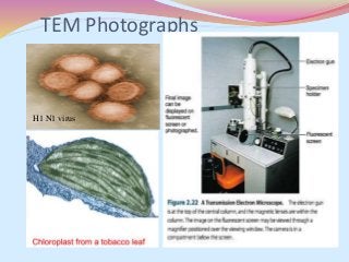 TEM Photographs
H1 N1 virus
 