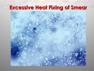 EExxcceessssiivvee HHeeaatt FFiixxiinngg ooff SSmmeeaarr 
 