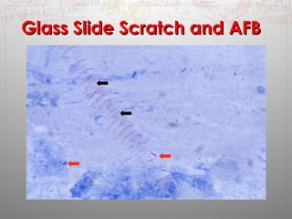 GGllaassss SSlliiddee SSccrraattcchh aanndd AAFFBB 
 