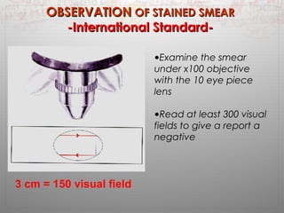 OOBBSSEERRVVAATTIIOONN OOFF SSTTAAIINNEEDD SSMMEEAARR 
--IInntteerrnnaattiioonnaall SSttaannddaarrdd-- 
3 cm = 150 visual field 
•Examine the smear 
under x100 objective 
with the 10 eye piece 
lens 
•Read at least 300 visual 
fields to give a report a 
negative 
 