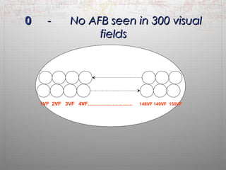 00 -- NNoo AAFFBB sseeeenn iinn 330000 vviissuuaall 
ffiieellddss 
1VF 2VF 3VF 4VF................................ 148VF 149VF 150VF 
 