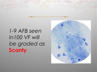 11--99 AAFFBB sseeeenn 
iinn110000 VVFF wwiillll 
bbee ggrraaddeedd aass 
Scanty 
 