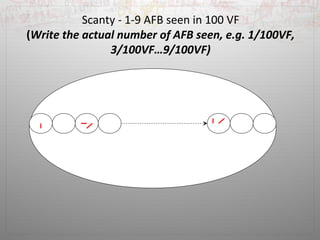 Scanty - 1-9 AFB seen in 100 VF 
(Write the actual number of AFB seen, e.g. 1/100VF, 
3/100VF…9/100VF) 
 