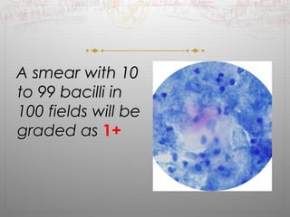 AA ssmmeeaarr wwiitthh 1100 
ttoo 9999 bbaacciillllii iinn 
110000 ffiieellddss wwiillll bbee 
ggrraaddeedd aass 1+ 
 