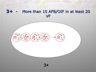 33++ -- MMoorree tthhaann 1100 AAFFBB//OOIIFF iinn aatt lleeaasstt 2200 
VVFF 
3+ 
 