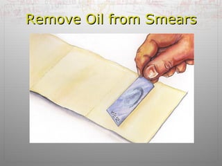 RReemmoovvee OOiill ffrroomm SSmmeeaarrss 
 