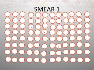 SMEAR 1 
 