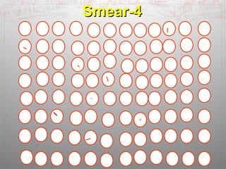 SSmmeeaarr--44 
 