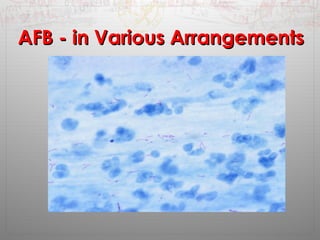 AAFFBB -- iinn VVaarriioouuss AArrrraannggeemmeennttss 
 