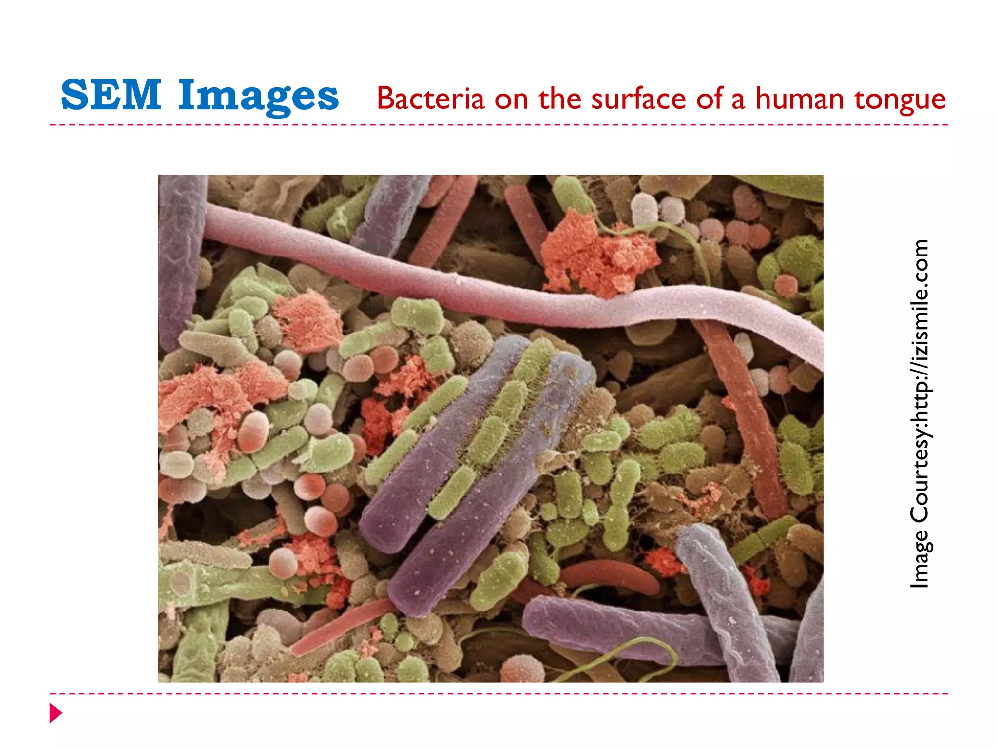 SEM Images Bacteria on the surface of a human tongue
ImageCourtesy:http://izismile.com
 