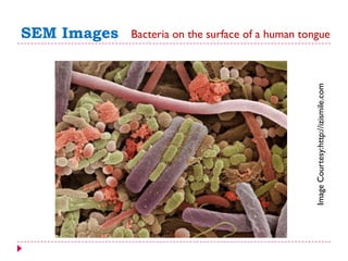 SEM Images Bacteria on the surface of a human tongue
ImageCourtesy:http://izismile.com
 