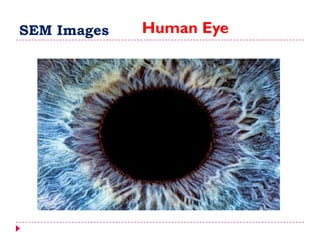 SEM Images Human Eye
 