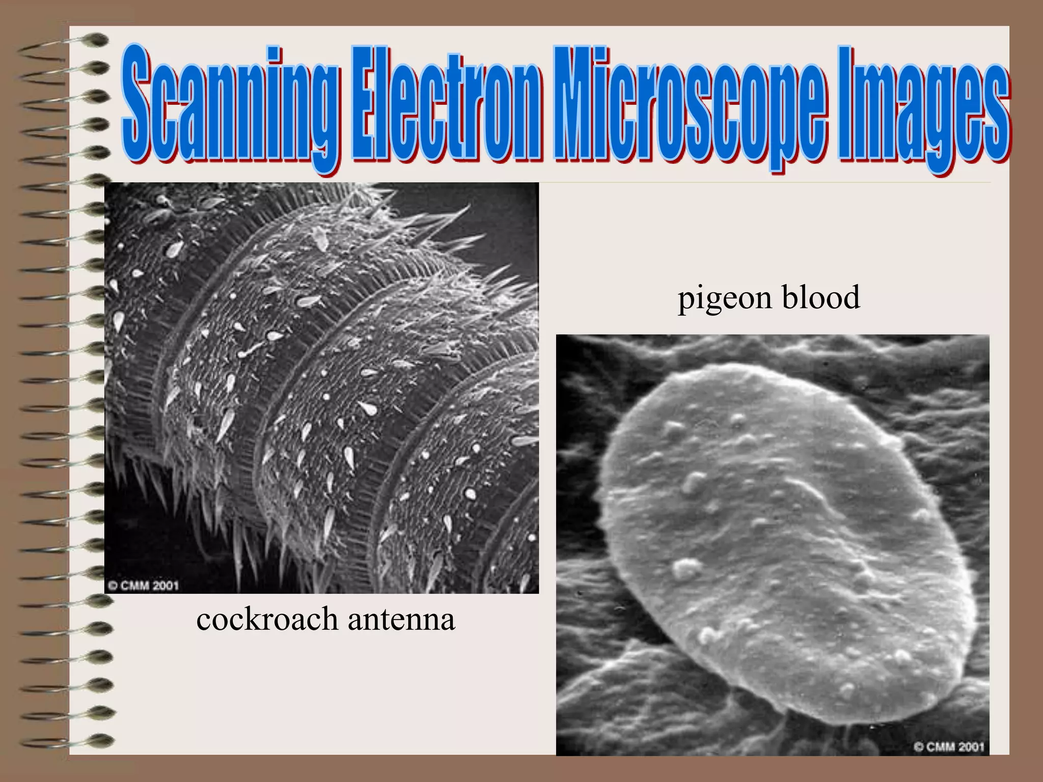 cockroach antenna
pigeon blood
 