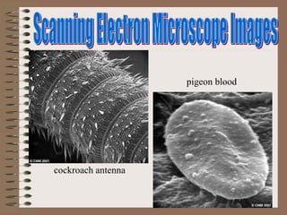 cockroach antenna
pigeon blood
 