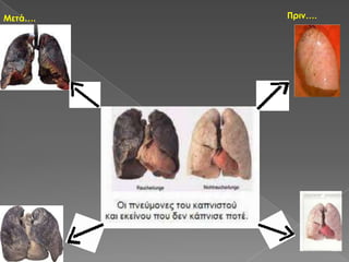 Πριν….Μετά….
 