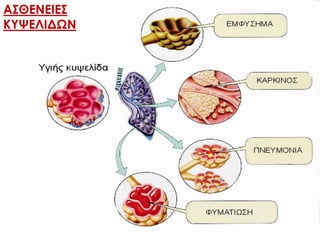 ΑΣΘΕΝΕΙΕΣ
ΚΥΨΕΛΙΔΩΝ
 