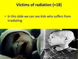 Victims of radiation (+18)

• In this slide we can see kids who suffers from
  irradiating
 