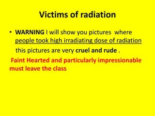 Victims of radiation
• WARNING I will show you pictures where
  people took high irradiating dose of radiation
   this pictures are very cruel and rude .
 Faint Hearted and particularly impressionable
must leave the class
 