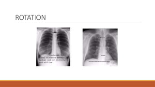 ROTATION
 