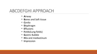 ABCDEFGHI APPROACH
 