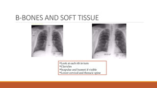 B-BONES AND SOFT TISSUE
 
