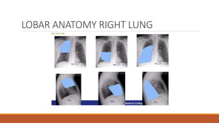 LOBAR ANATOMY RIGHT LUNG
 