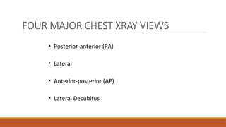 FOUR MAJOR CHEST XRAY VIEWS
 