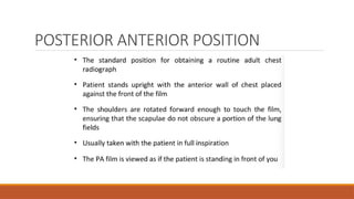 POSTERIOR ANTERIOR POSITION
 