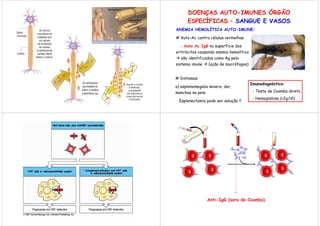 DOENÇAS AUTO-IMUNES ÓRGÃO
      ESPECÍFICAS – SANGUE E VASOS
ANEMIA HEMOLÍTICA AUTO-IMUNE:

# Auto-Ac contra células vermelhas

  - Auto Ac IgG na superfície dos
eritrócitos causando anemia hemolítica
   são identificados como Ag pelo
sistema imune     (ação de macrófagos)


# Sintomas:
                                         Imunodiagnóstico:
a) esplenomegalia severa, dor,
manchas na pele                           - Teste de Coombs direto
                                          - Hemoglobina (<2g/dl)
 Esplenectomia pode ser solução !!




                  Anti-IgG (soro de Coombs)
 