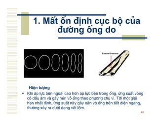 1. MÊt æn ®Þnh côc bé cña
         ®−êng èng do




 HiÖn t−îng
Khi ¸p lùc bªn ngo i cao h¬n ¸p lùc bªn trong èng, øng suÊt vßng
cã dÊu ©m v g©y nÐn vá èng theo ph−¬ng chu vi. Tíi mét giãi
h¹n nhÊt ®Þnh, øng suÊt n y g©y o»n vá èng trªn tiÕt diÖn ngang,
th−êng x¶y ra d−íi d¹ng vÕt lâm.
                                                              48
 