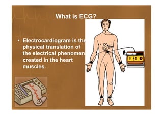 Define Ecg Basics of ECG | PDF