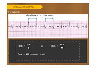 Basics of ECG | PDF