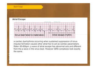Basics of ECG | PDF
