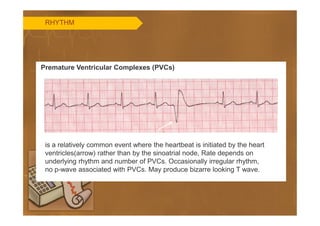 Basics of ECG | PDF