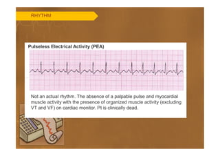 Pea Rythm Monitor Basics of ECG | PDF