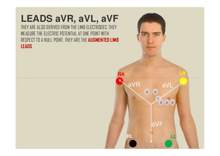 Basics of ECG