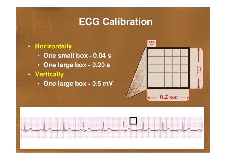 Basics of ECG