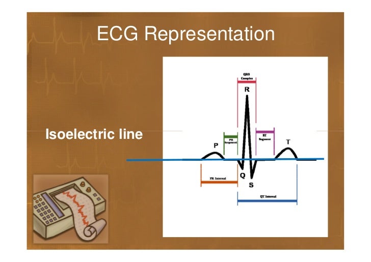 What Is The Isoelectric Line Of The Ecg