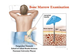 Bone Marrow Examination




     Nungruthai Nimnuch
School of Allied Health Sciences           1
  Naresuan University Phayao
 