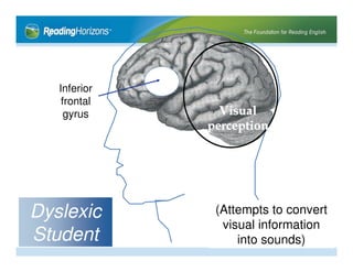 Dyslexia: From Symptoms to Solutions | PPT