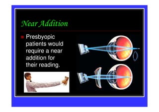 Near Addition
 Presbyopic
 patients would
 require a near
 addition for
 their reading.
 